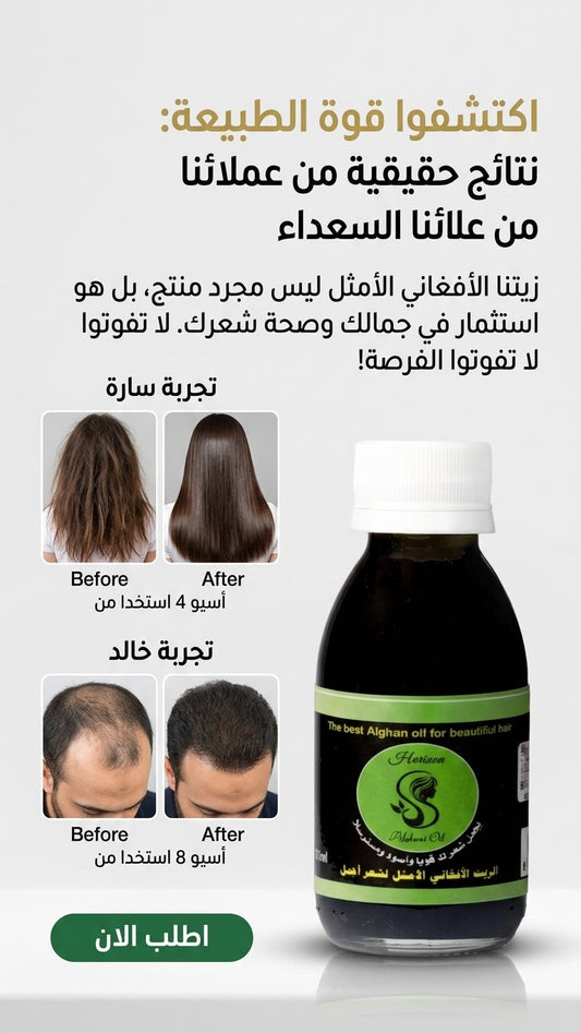 فوائد الزيت الأفغاني للحواجب والرموش - متجر الزيت الافغاني الامثل للشعر - فوائد الزيت الأفغاني للحواجب والرموش - متجر الزيت الافغاني الامثل للشعر