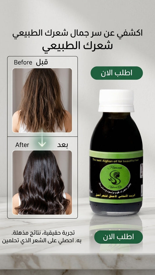 الزيت الأفغاني للحوامل: هل هو آمن؟ - متجر الزيت الافغاني الامثل للشعر - الزيت الأفغاني للحوامل: هل هو آمن؟ - متجر الزيت الافغاني الامثل للشعر