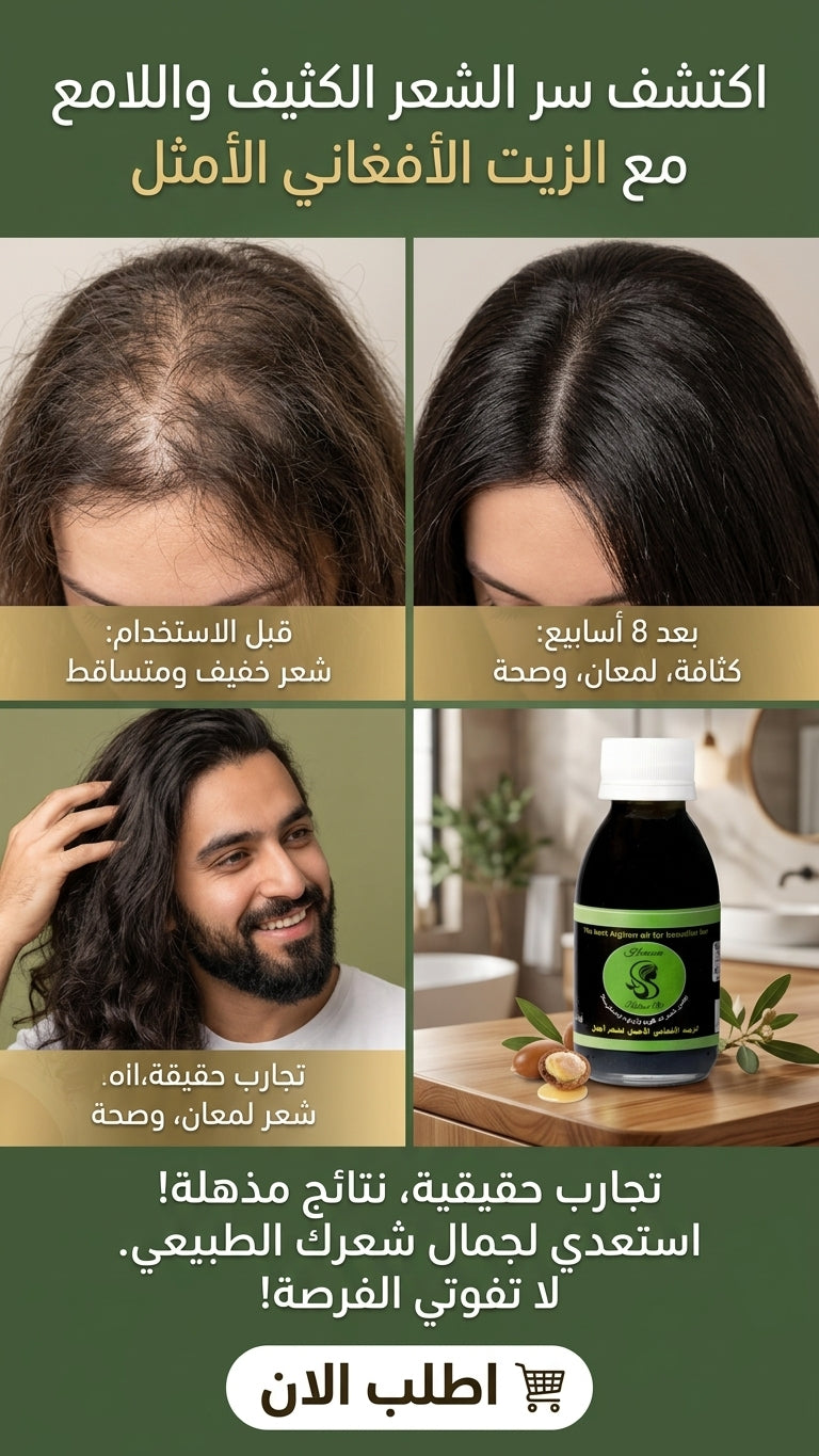 الزيت الأفغاني للشعر بعد الولادة - متجر الزيت الافغاني الامثل للشعر - الزيت الأفغاني للشعر بعد الولادة - متجر الزيت الافغاني الامثل للشعر