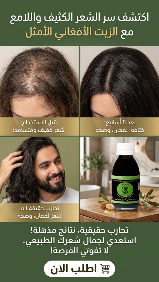 الزيت الأفغاني للشعر بعد الولادة - متجر الزيت الافغاني الامثل للشعر - الزيت الأفغاني للشعر بعد الولادة - متجر الزيت الافغاني الامثل للشعر