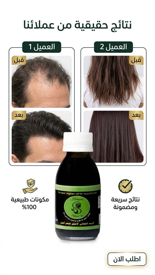 كيف تميز الزيت الأفغاني الأصلي من المقلد؟ - متجر الزيت الافغاني الامثل للشعر - كيف تميز الزيت الأفغاني الأصلي من المقلد؟ - متجر الزيت الافغاني الامثل للشعر