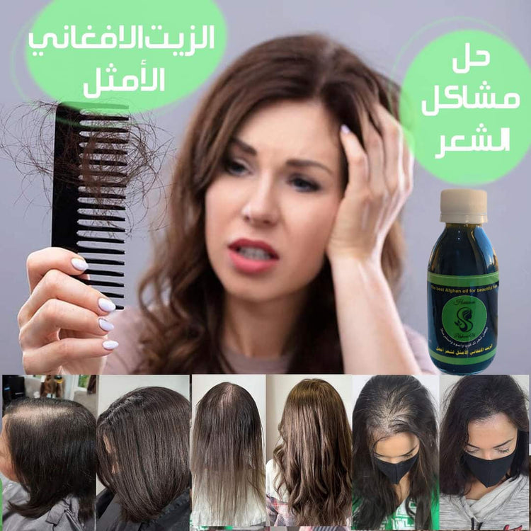 منتجات متنوعة بأسعار رائعة في مجموعة جميع المنتجات المميزة - زيت أفغاني أصلي لعلاج تساقط الشعر