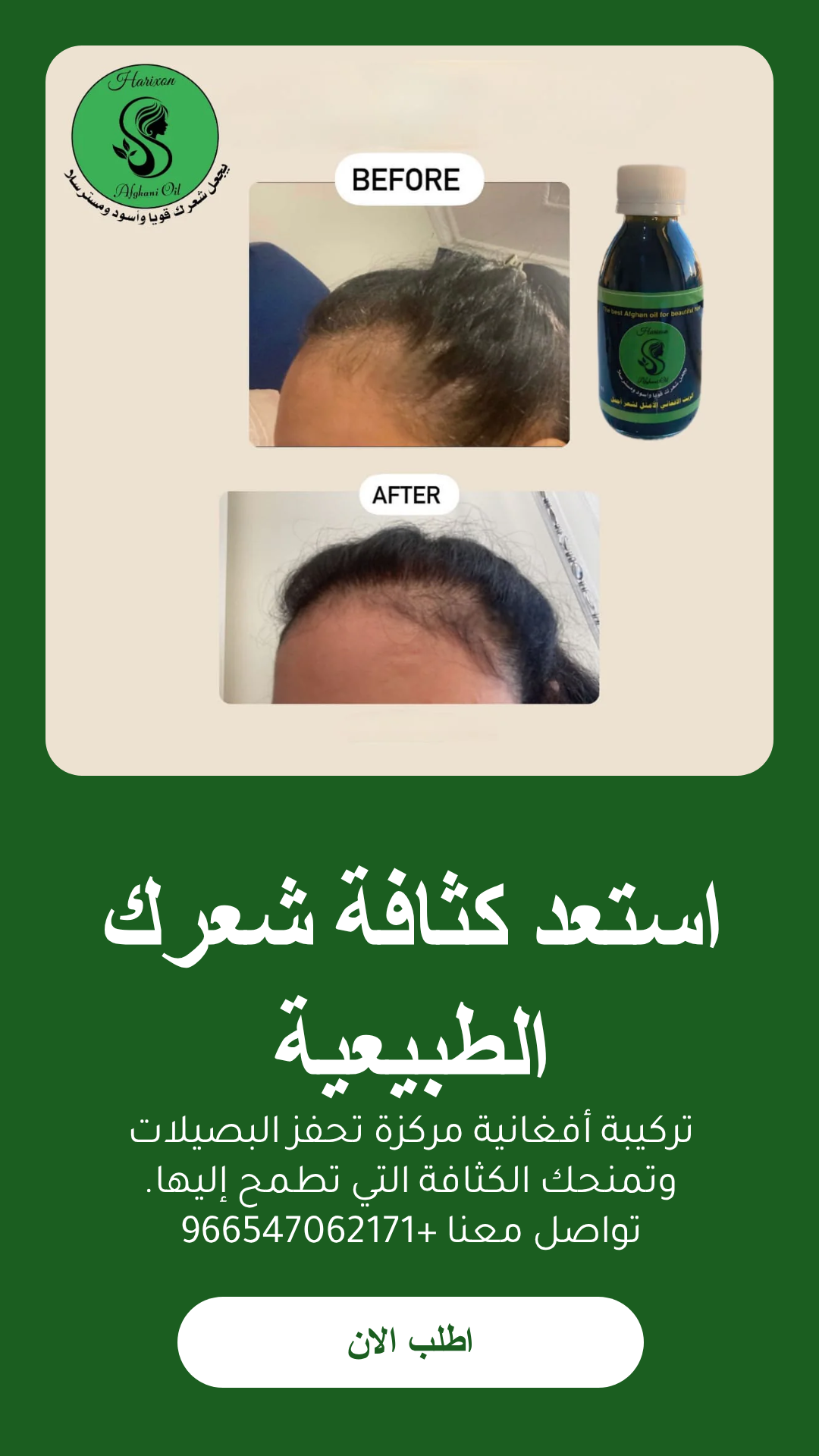 عرض افضل زيت للشعر مع مشط محترف وشحن مجاني وعناية فريدة للشعر
