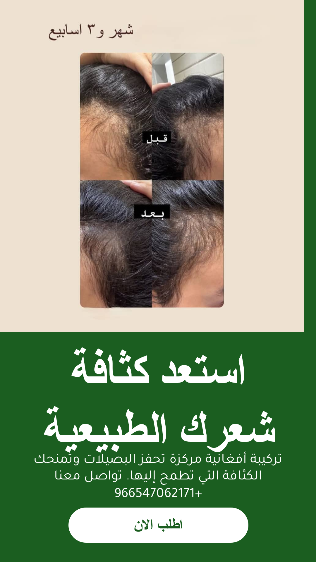 عرض افضل زيت للشعر مع مشط محترف وشحن مجاني وعناية فريدة للشعر