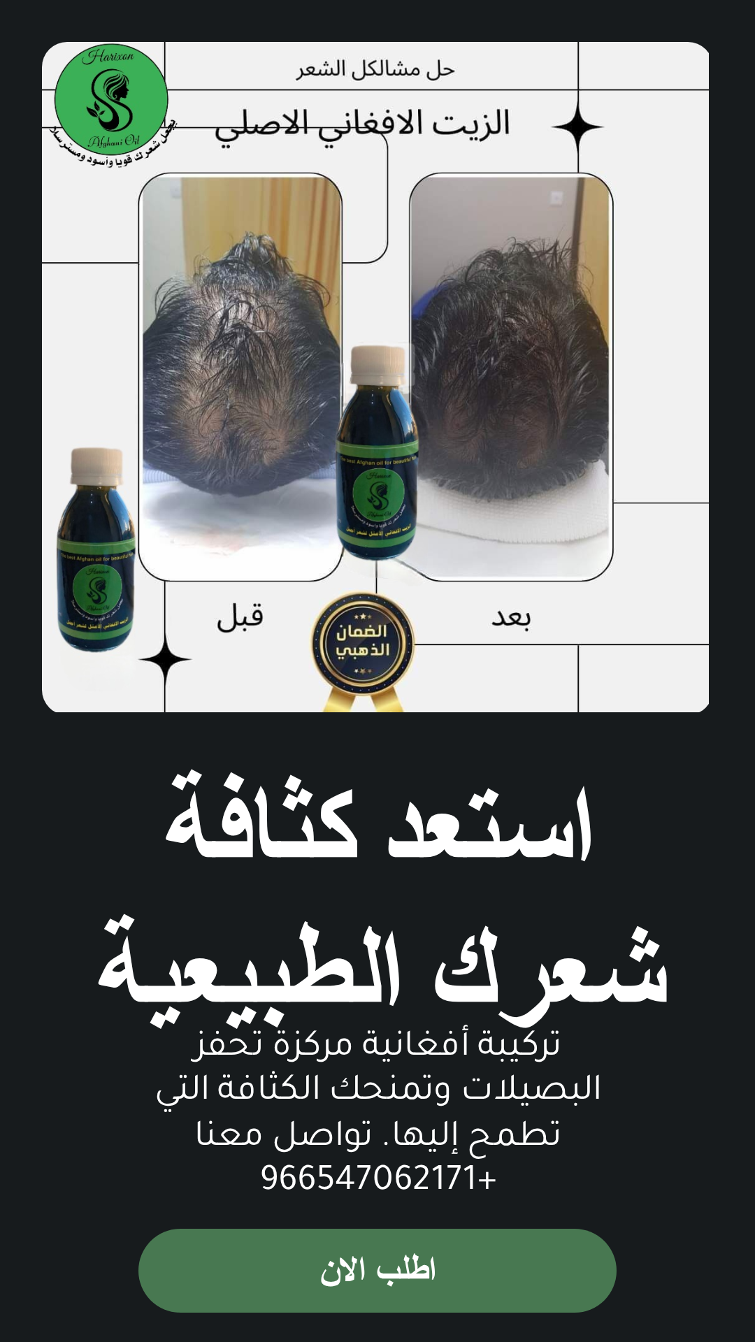 عرض علبة مشط توزيع الزيت كهدية مميزة لعلاج التساقط
