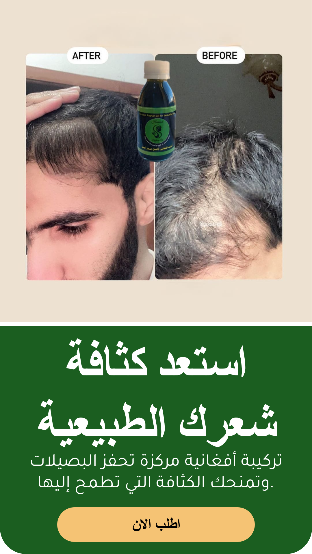 عرض افضل زيت للشعر مع مشط محترف وشحن مجاني وعناية فريدة للشعر