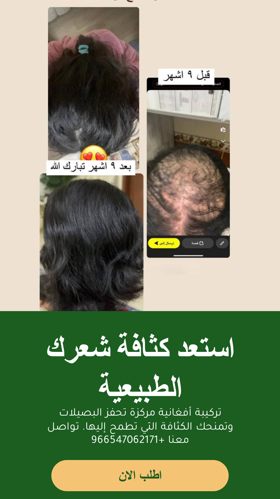 عرض افضل زيت للشعر مع مشط محترف وشحن مجاني وعناية فريدة للشعر
