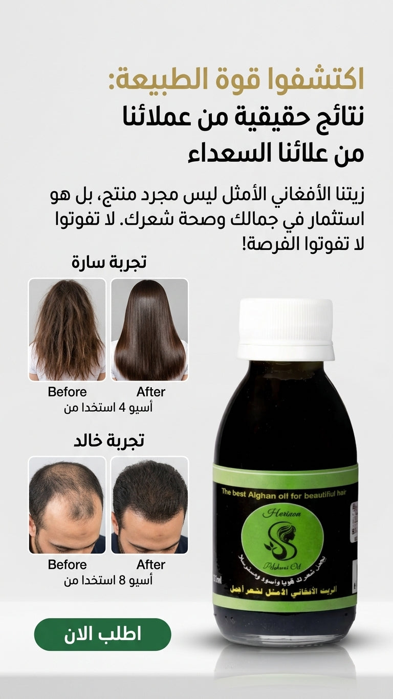 عرض خاص: علبتين من الزيت الافغاني لعلاج تساقط الشعر + علبة مجانية مع مشط هدية - متجر الزيت الافغاني الامثل للشعر